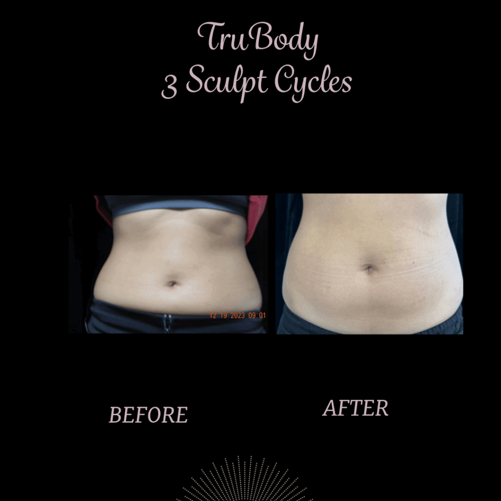 trubody results for fat loss and muscle toning in Anchorage, Alaska
